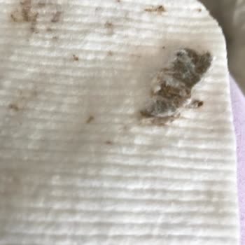 Bebek Ürünlerinde Güvenlik Sorunu