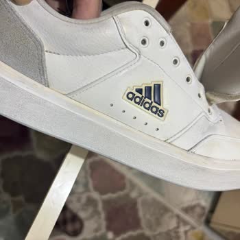 Adidas Ayakkabıda Beklenmedik Sararma Problemi