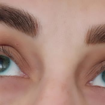 Yanlış Renk Lens Ve İade Sorunu