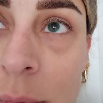 Yanlış Renk Lens Ve İade Sorunu