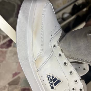 adidas Sent Me Park Street Shoes That Turned Yellow After a Few Uses