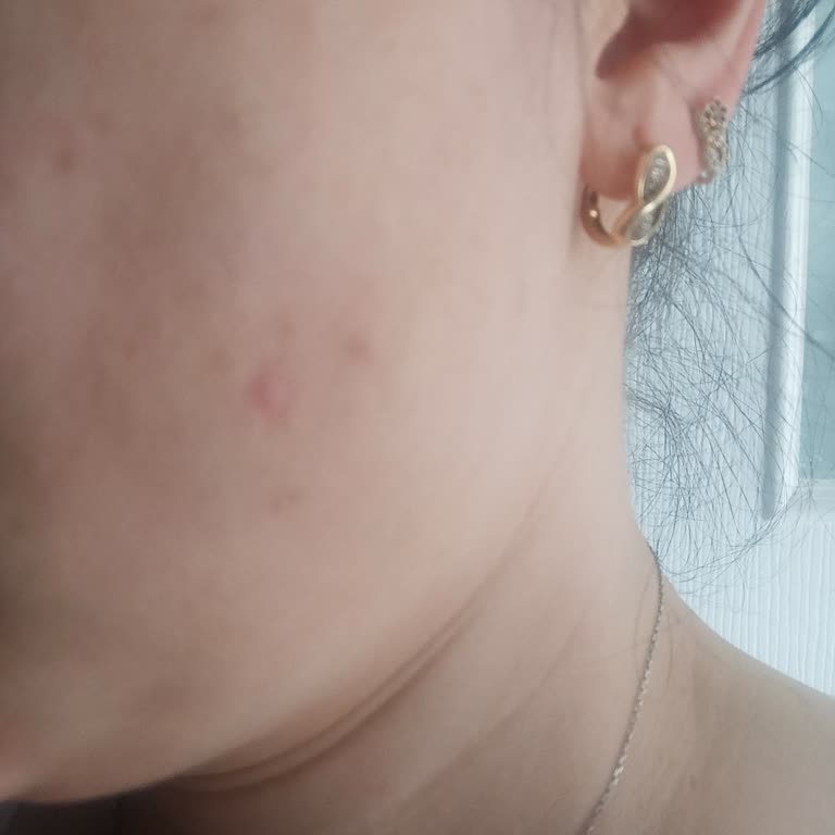 Estemor Güzellik Salonu (Çorlu) Yanlış Faturalama Ve Yetersiz Hizmetle Mağduriyet