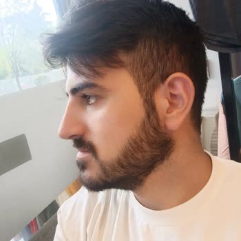 Asya Hastanesi Rinoplasti Sonrası Asimetrik Ve Büyük Burun Sorunu