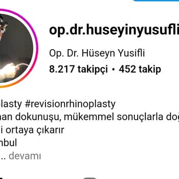 Asya Hastanesi Rinoplasti Sonrası Asimetrik Ve Büyük Burun Sorunu