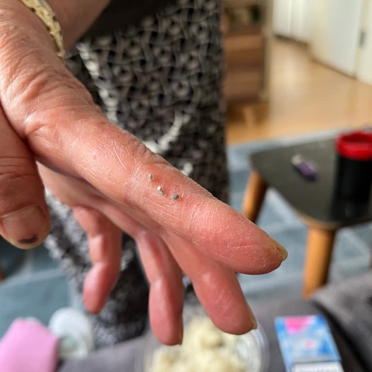 Glütensiz Ürünlerde Güven Sorunu: Basmati Pirinçte Beklenmedik Sürprizler