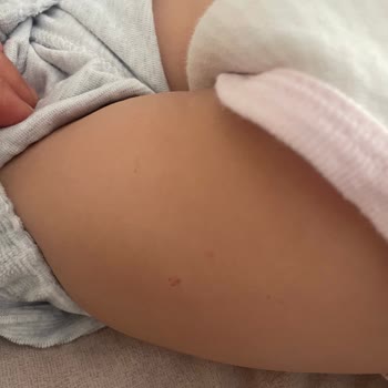 Mustela Kremi Bebeğimin Cildini Kötüleştirdi