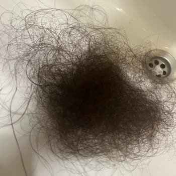 Elidor Şampuan Saç Dökülmesine Neden Oldu