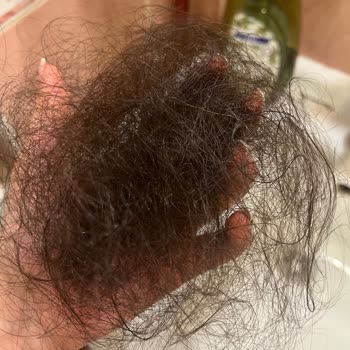 Elidor Şampuan Saç Dökülmesine Neden Oldu