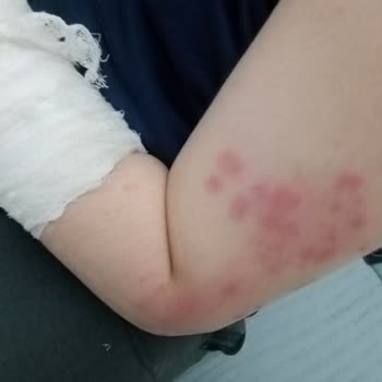 Şenpiliç Tavukları Yüzünden Hastanelik Olduk