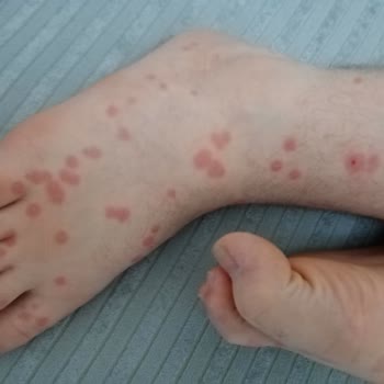 Şenpiliç Tavukları Yüzünden Hastanelik Olduk