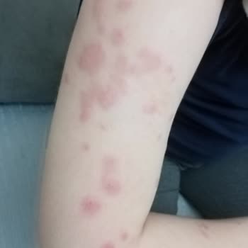 Şenpiliç Tavukları Yüzünden Hastanelik Olduk