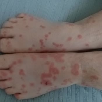 Şenpiliç Tavukları Yüzünden Hastanelik Olduk