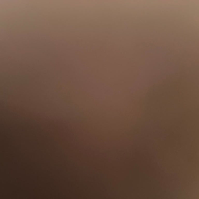 Lazer Epilasyon Paketinde İade Sorunu