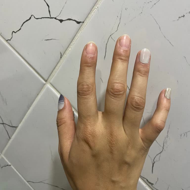 Beklentileri Karşılamayan Protez Tırnak Deneyimi