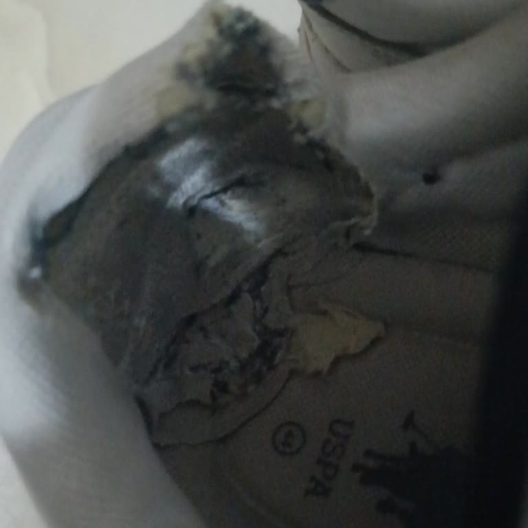 Garanti Kapsamında Ayakkabı Deformasyonu Sorunu