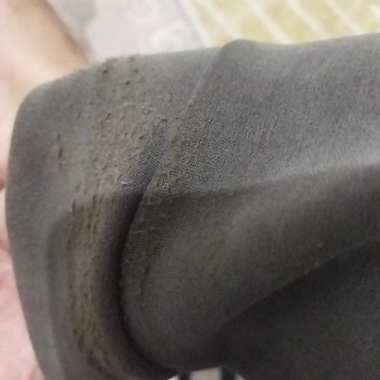 Slazenger Eşofmanda Dikiş Ve Kalite Sorunu