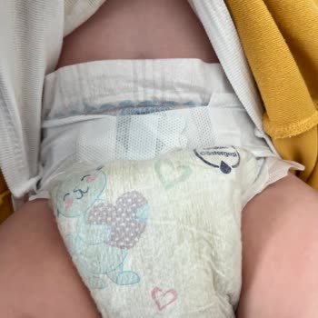 Molfix Bebek Bezi Sızıntı Sorunu Ve Hasta Çocuk