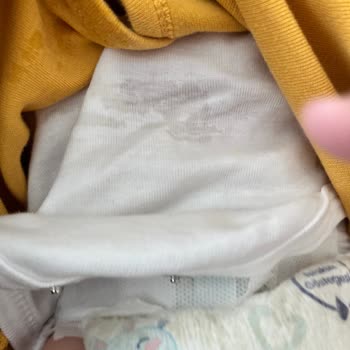 Molfix Bebek Bezi Sızıntı Sorunu Ve Hasta Çocuk