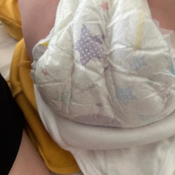 Molfix Bebek Bezi Sızıntı Sorunu Ve Hasta Çocuk