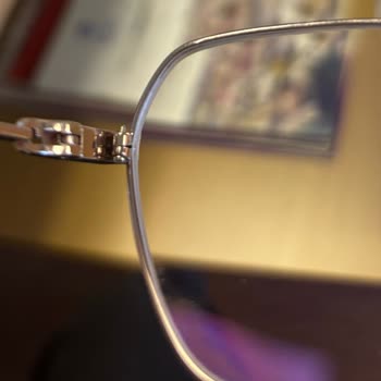 Gözlük Tamiratında Uygunsuz Vida Ve Mağaza Çözüm Eksikliği