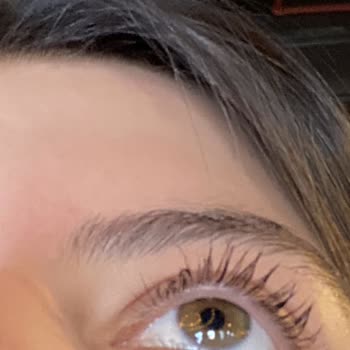 Epilasyon Seansında Yaşanan Sorun Ve İletişim Eksikliği