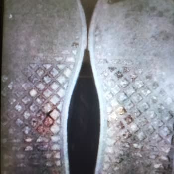 Deichmann Ayakkabıda Beklenmedik Yırtılma Ve Çözüm Arayışı
