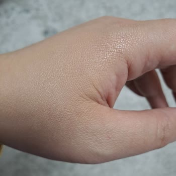 Cilt Hassasiyetini Arttıran Ürün Deneyimi: Hayal Kırıklığı Ve Üzüntü