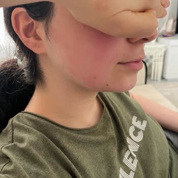 Hediye Ürün Ciltte Sorun Yarattı