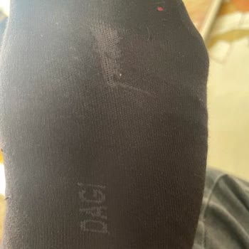 Dagi Çoraplarında Hızlı Deformasyon Sorunu
