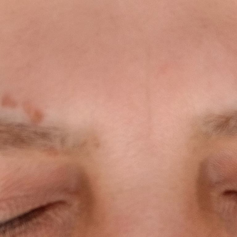 Saç Boyası Kullanımı Sonrası Cilt Sorunları