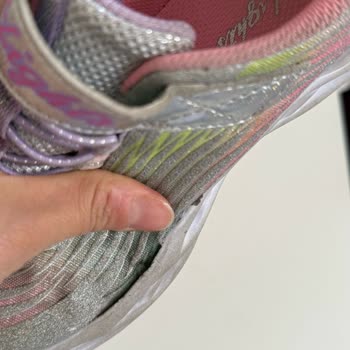 Skechers Çocuk Ayakkabısında Kalite Sorunu Ve İade Reddi