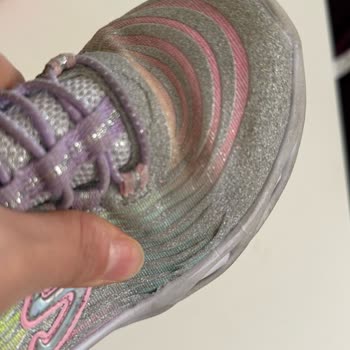 Skechers Çocuk Ayakkabısında Kalite Sorunu Ve İade Reddi