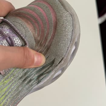 Skechers Çocuk Ayakkabısında Kalite Sorunu Ve İade Reddi