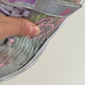 Skechers Çocuk Ayakkabısında Kalite Sorunu Ve İade Reddi