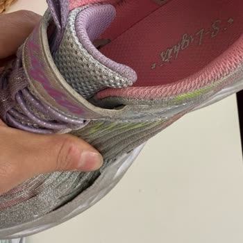 Skechers Çocuk Ayakkabısında Kalite Sorunu Ve İade Reddi