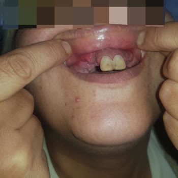 Muayene Sırasında Kaba Davranış Ve İlgisizlik
