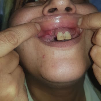 Muayene Sırasında Kaba Davranış Ve İlgisizlik