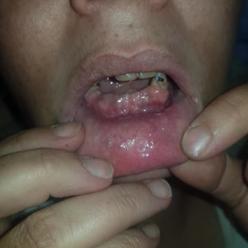 Muayene Sırasında Kaba Davranış Ve İlgisizlik