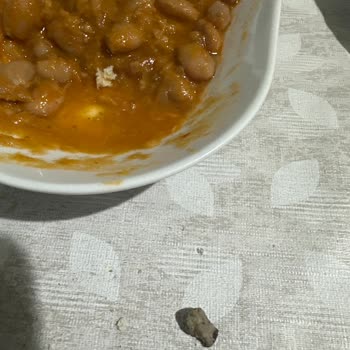 Barbunya Paketinde Tehlikeli Taş Sürprizi