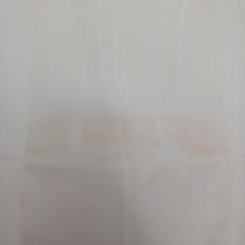 Lekeli Ürün Ve İade Sorunu Yaşadım