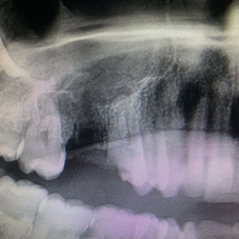 Attelia Ağız Ve Diş Sağlığı Merkezi Diş Çekimi Sonrası Kırık Diş ve Yetersiz Hizmet