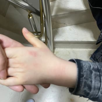 Oğlumun Ellerini Mahveden Ürün