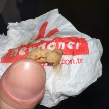 Hijyen Sorunlarıyla Dolu Bir Döner Deneyimi