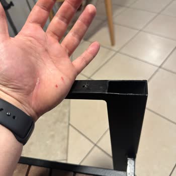 Eski Sandalyenin Tehlikesi: Dikkat Eksikliği Yaralanmaya Yol Açtı