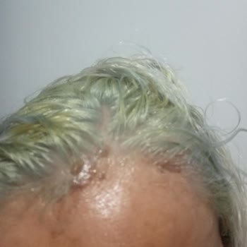 Saç Boyasında Beklenmedik Renk Ve Cilt Sorunu