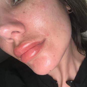 Kiko Ürünleri Cildimde Sorun Yarattı