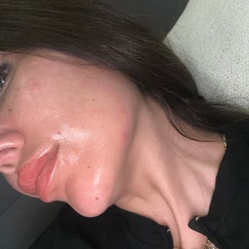 Kiko Ürünleri Cildimde Sorun Yarattı