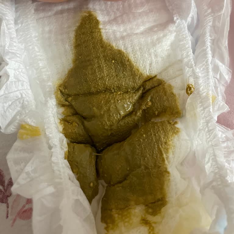 Bebek Maması Geçişinde Yeni Sorunlar: Gaz Gitti, Pişik Geldi