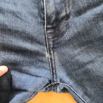 Mavi Pantolonun Deformasyon Sorunu Ve Mağduriyet