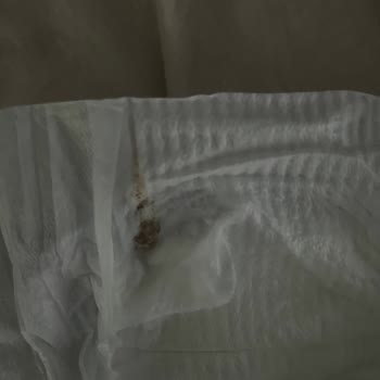 Bebek Bezinde Şok Edici Hata